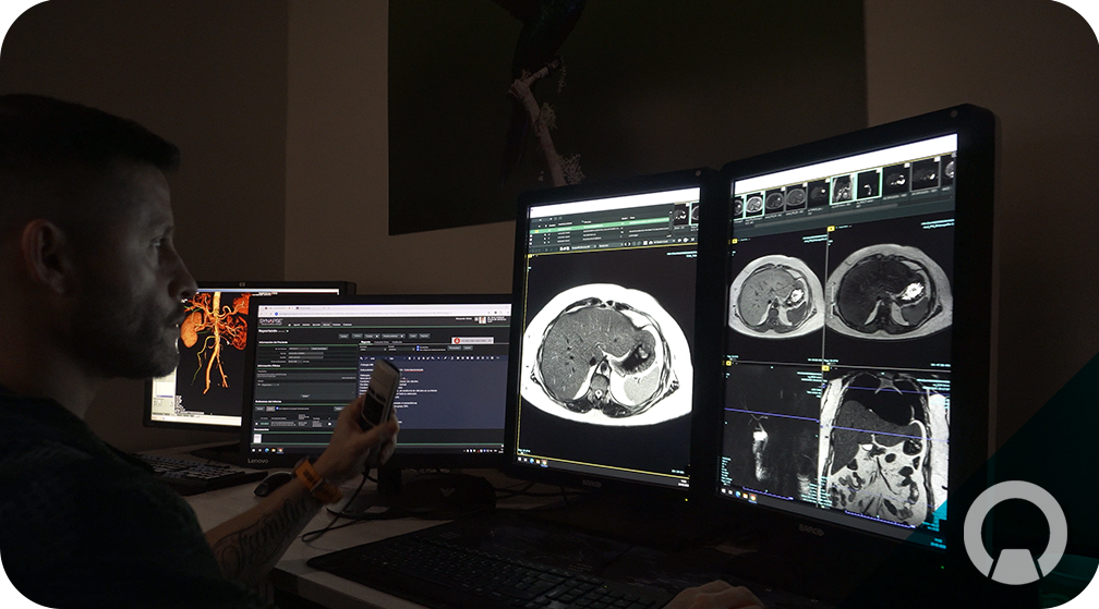 Serigrafía en Imagenología HGGB